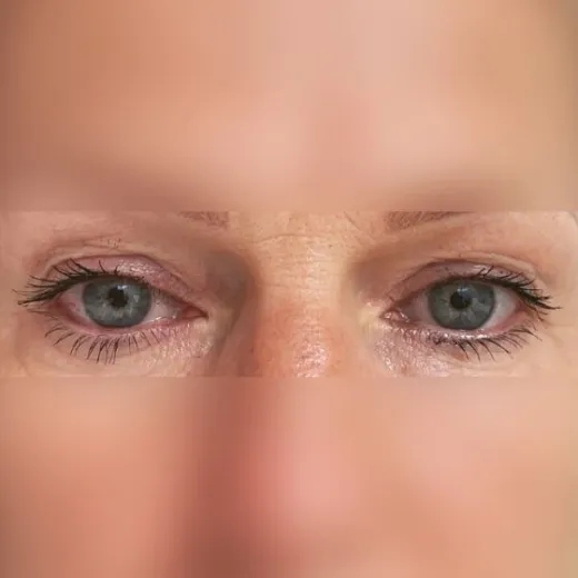 Image before