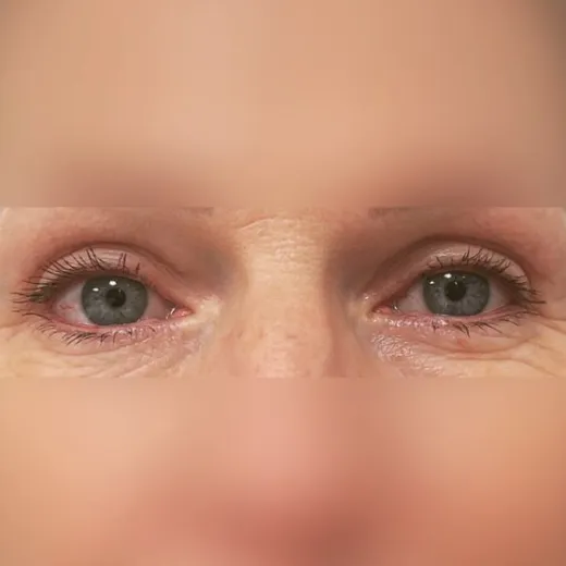 Image after
