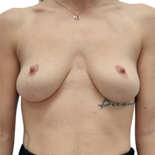 Image before