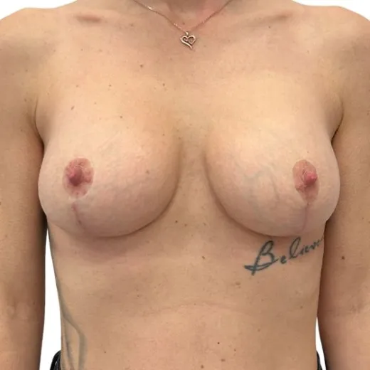 Image after