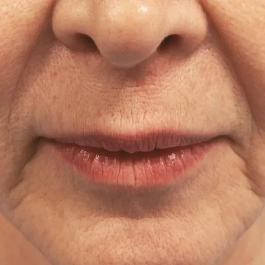 Image before