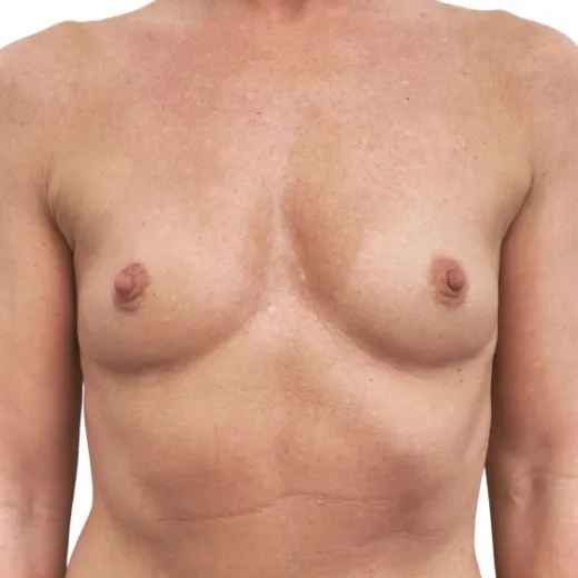Image before