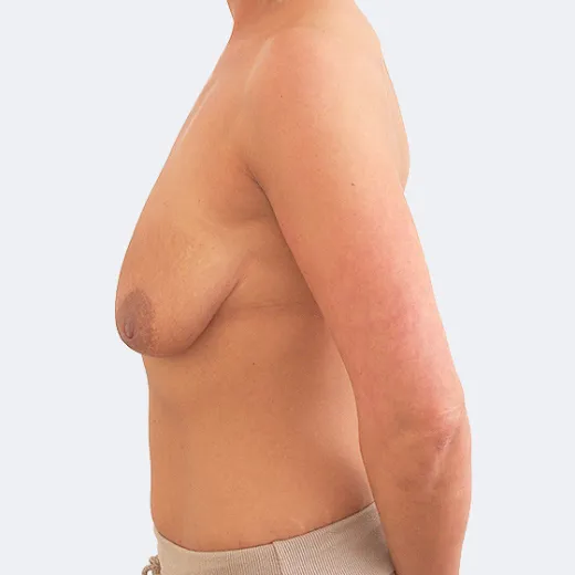 Image before
