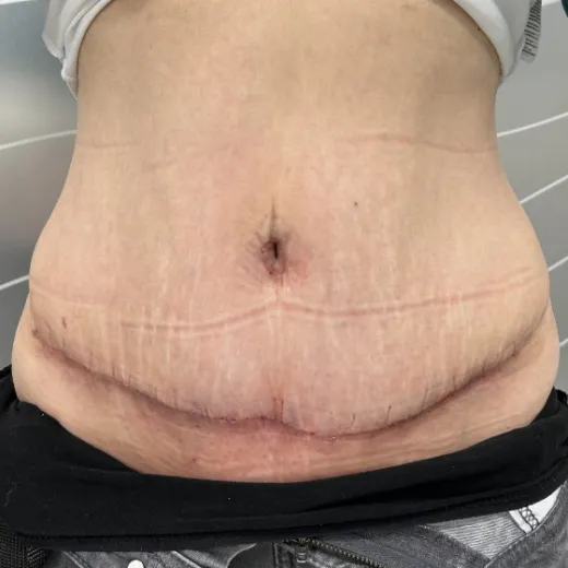 Image after