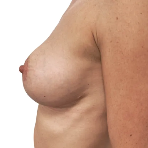 Image after
