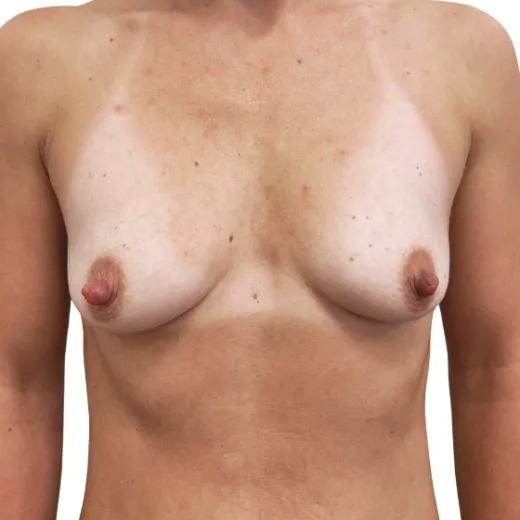 Image before