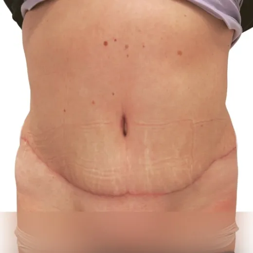 Image after