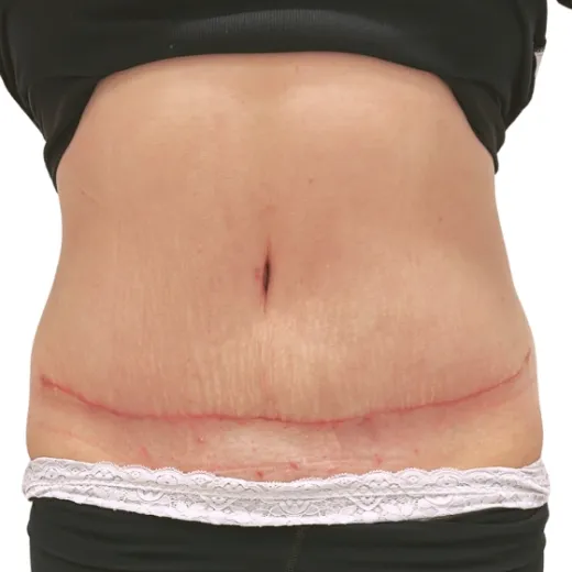 Image after