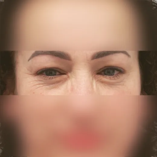 Image before