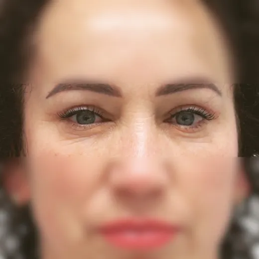 Image after