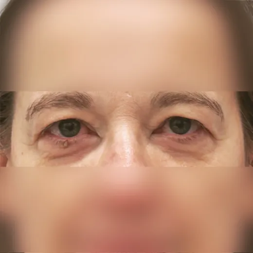 Image before