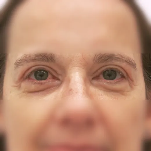 Image after