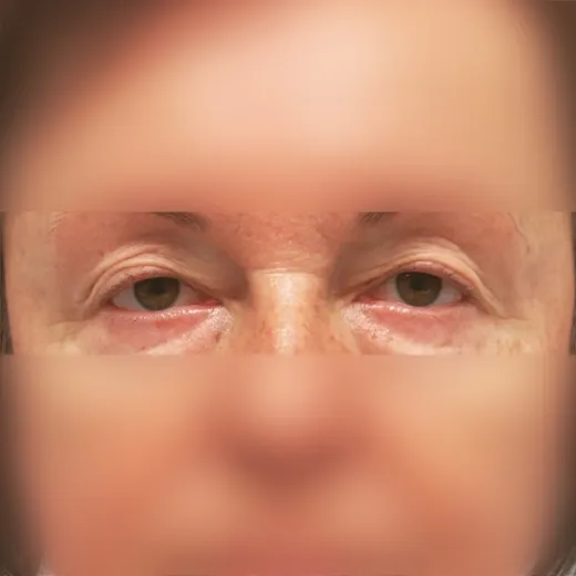 Image before