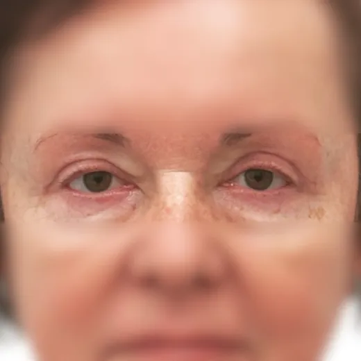 Image after