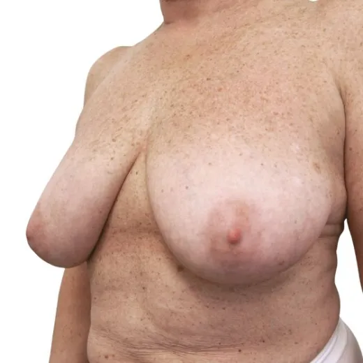 Image before