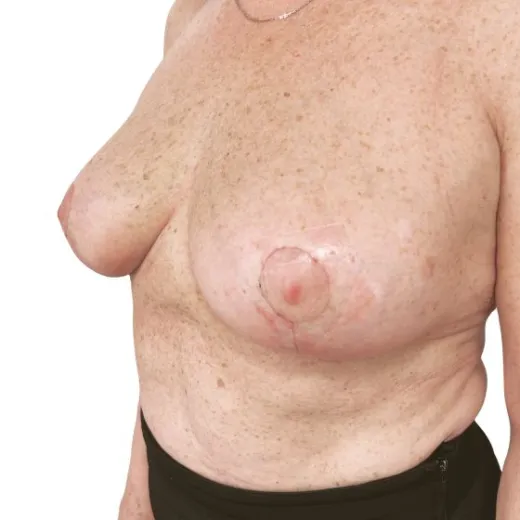 Image after