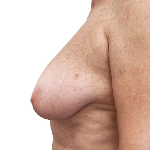 Image before