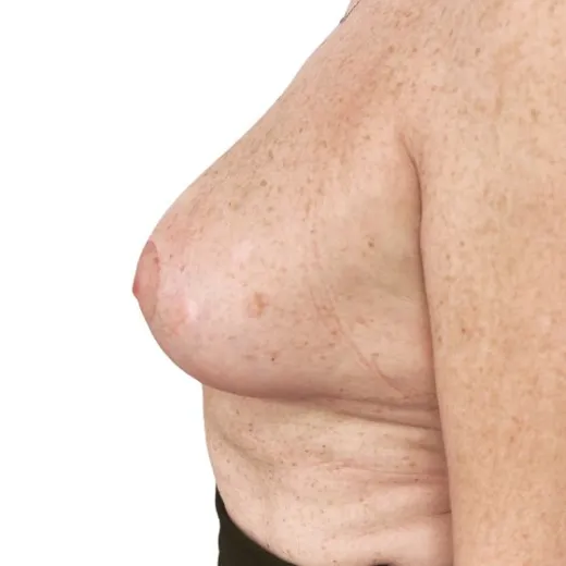 Image after