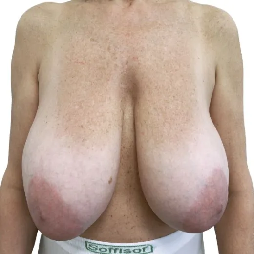Image before