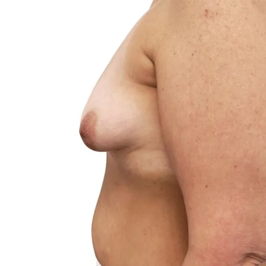 Image before