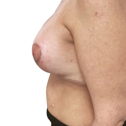 Image after