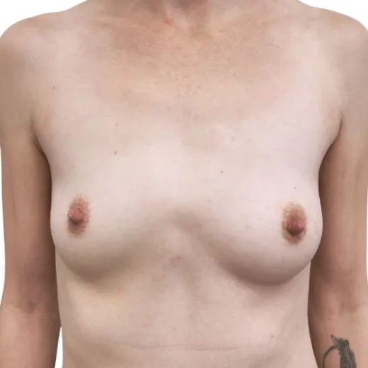 Image before