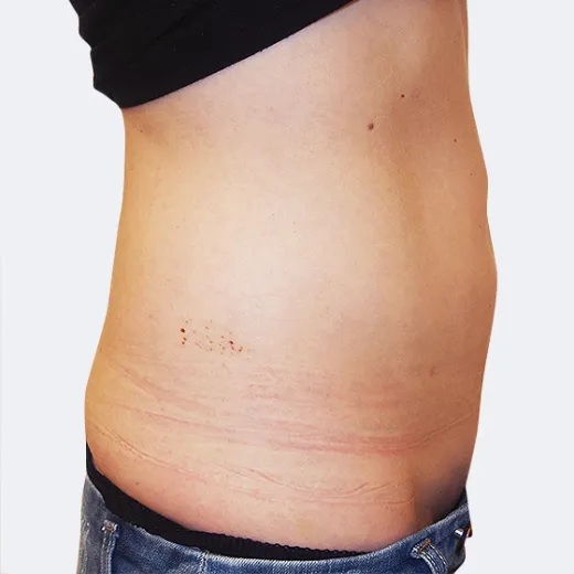 Image after