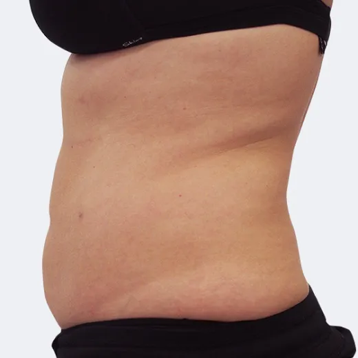 Image after