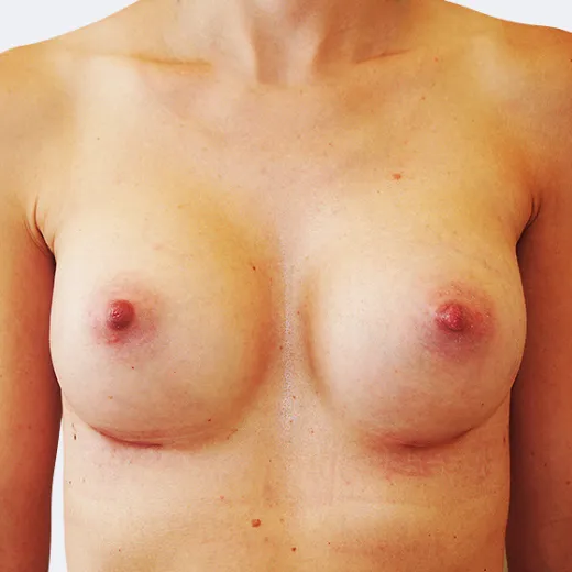 Image after
