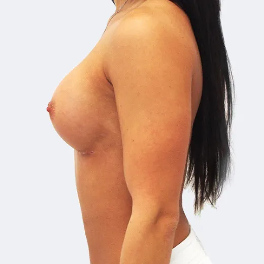 Image after