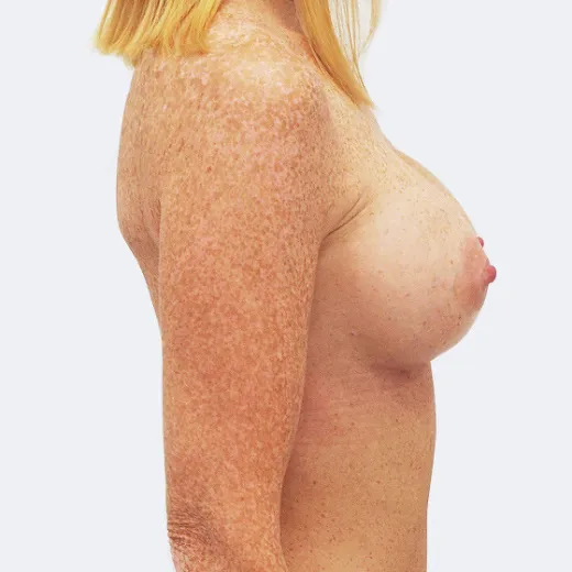 Image after