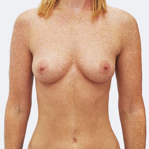 Image before