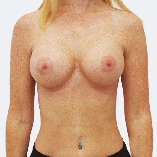 Image after