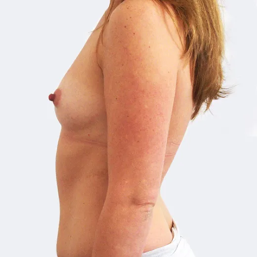 Image before