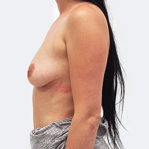 Image before