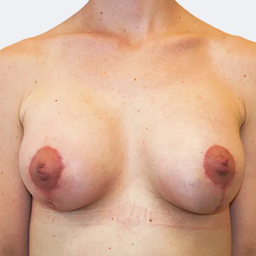 Image after