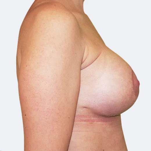 Image after