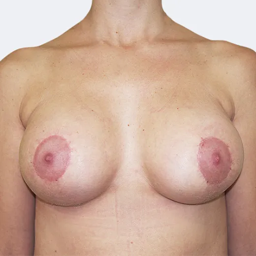 Image after
