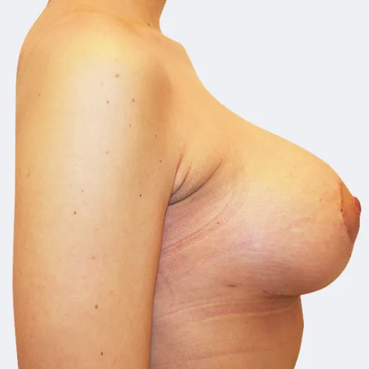Image after