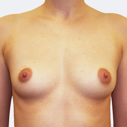 Image before