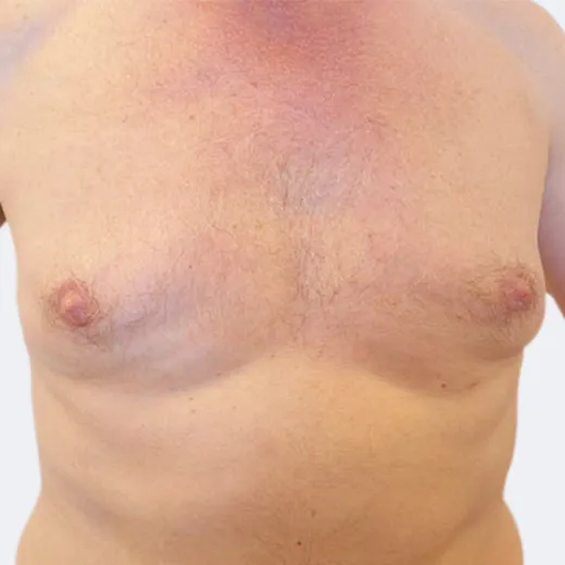 Image after
