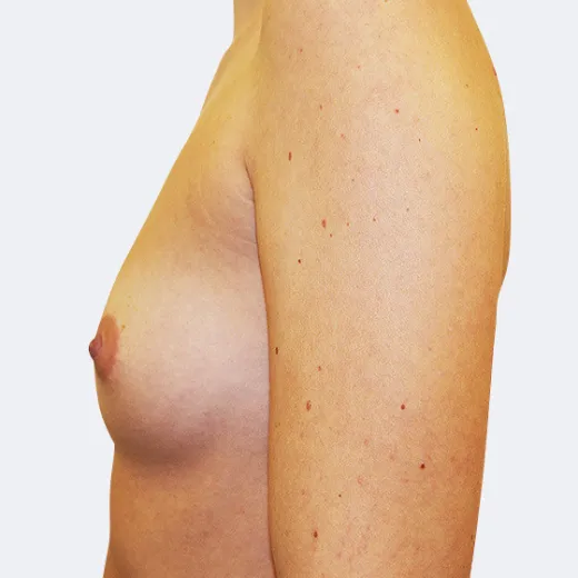 Image before