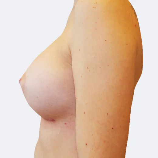 Image after