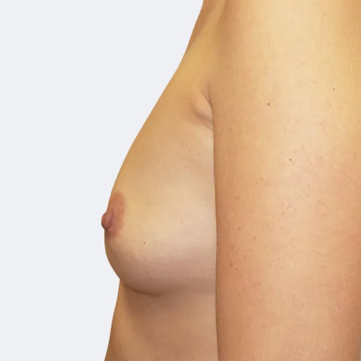 Image before