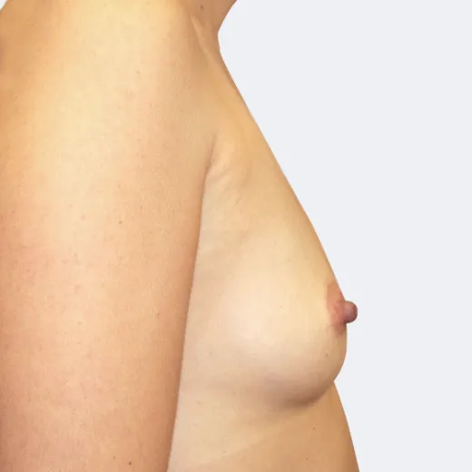 Image before