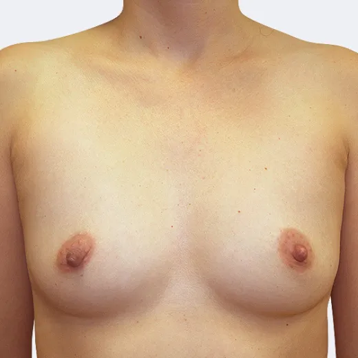 Image before