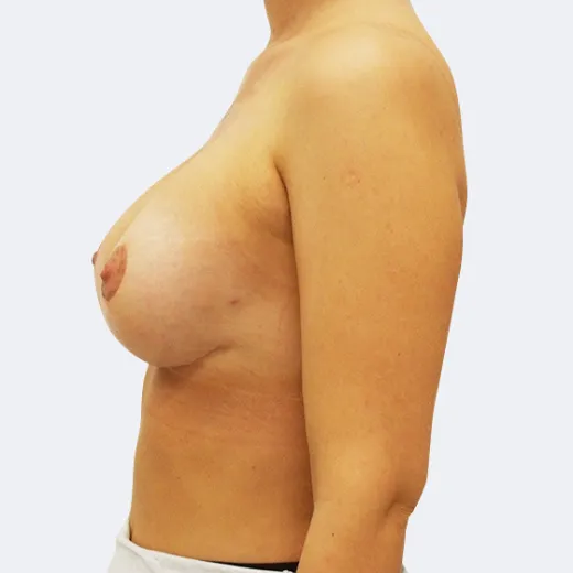 Image after