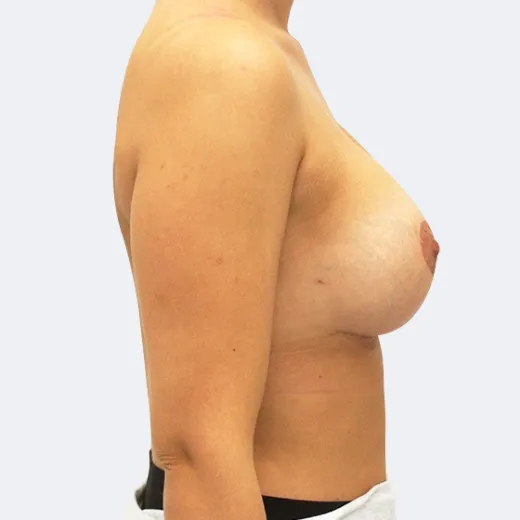 Image after