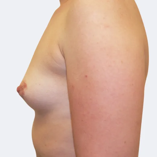 Image before