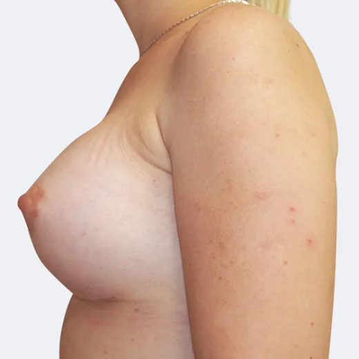 Image after